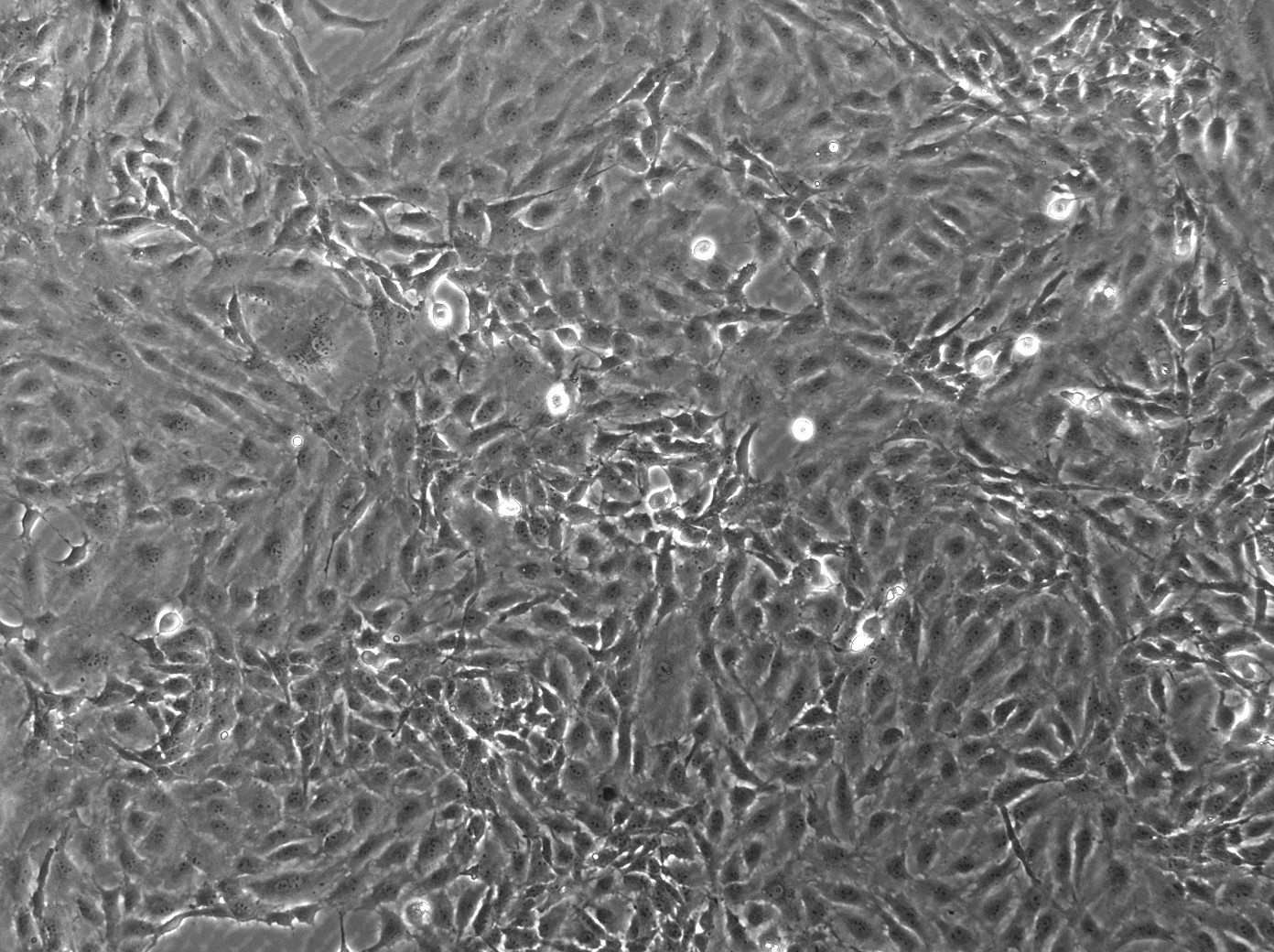 Porcine Aorta Endothelial Cells (PAECs)